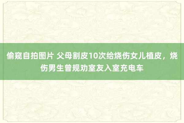 偷窥自拍图片 父母割皮10次给烧伤女儿植皮，烧伤男生曾规劝室友入室充电车